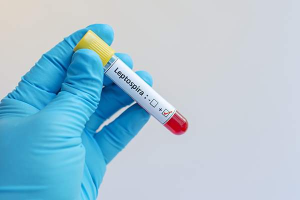 Leptospirosi esami
