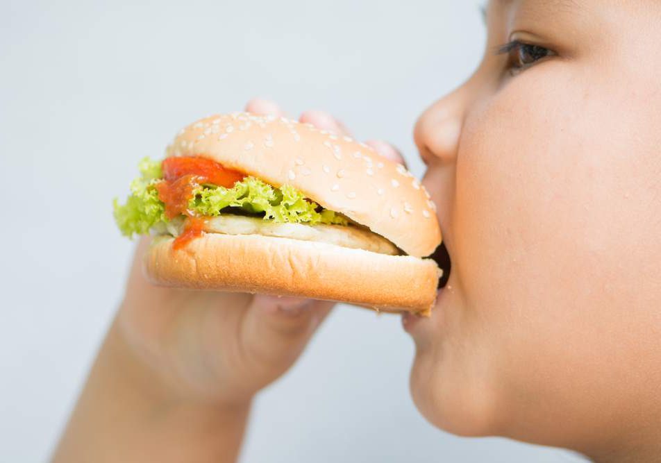 Obesità infantile cause