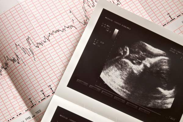 Malattie cardiache gravidanza controlli