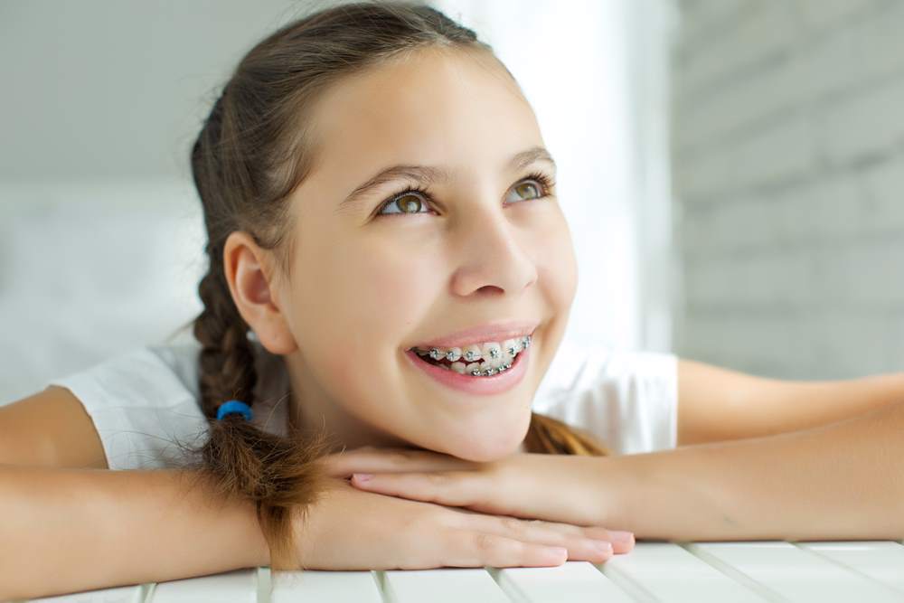 Apparecchio denti bambini