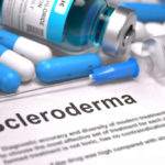 Sclerodermia