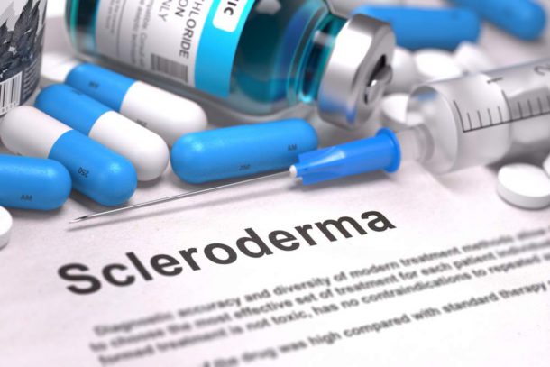 Sclerodermia