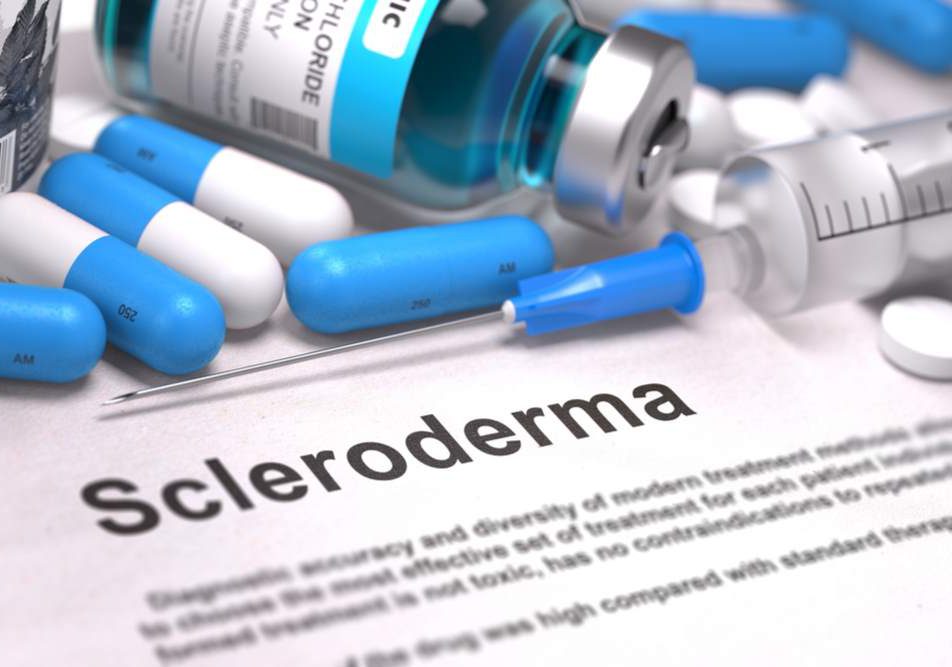 Sclerodermia