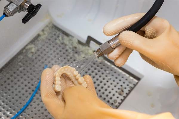 protesi dentale stampante 3d