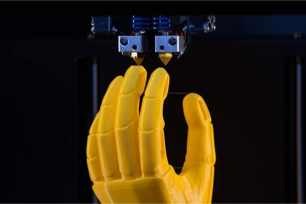 stampante 3d protesi mano