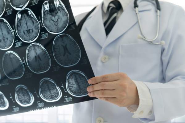 cefalea visita neurologica