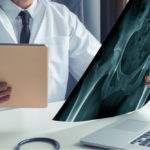 frattura femore anziani