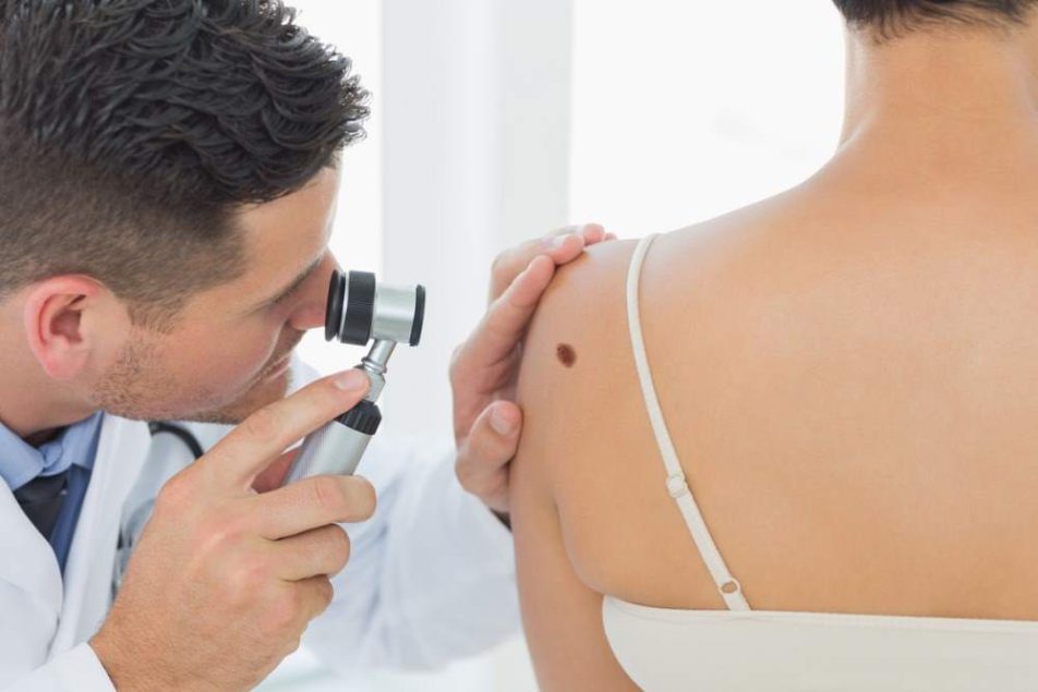 melanoma cutaneo