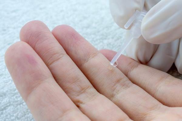 verruche come eliminarle