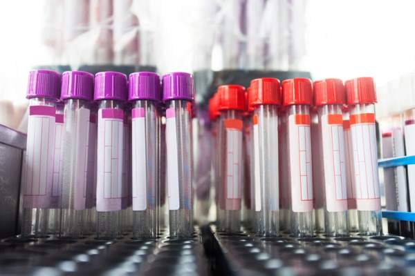 provette in laboratorio