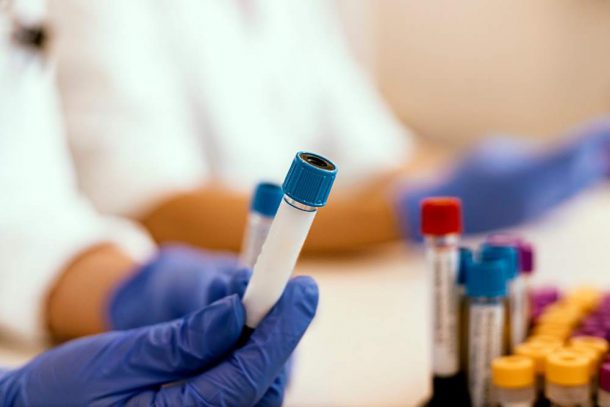 provette per esami del sangue