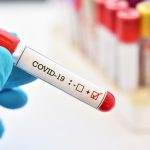 coronavirus test sierologici