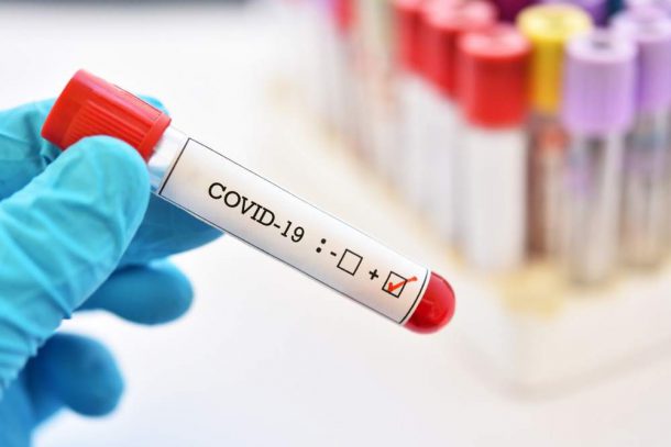 coronavirus test sierologici