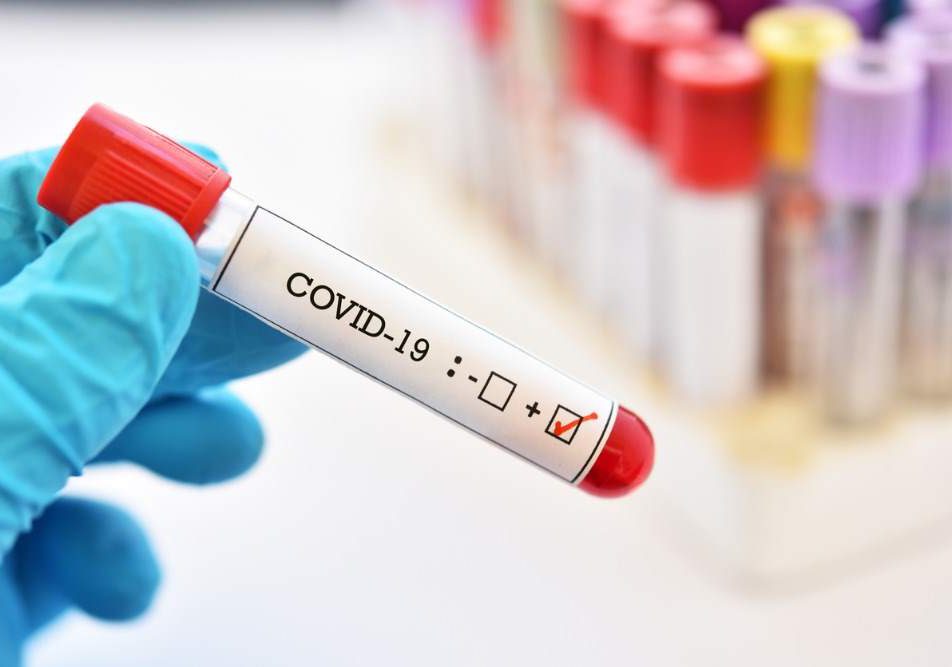coronavirus test sierologici