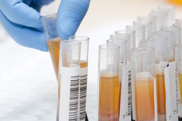 provette plasma test