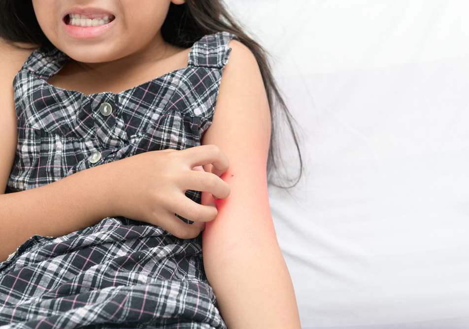 impetigine bambini immagini