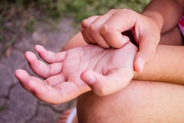 impetigine bollosa bambini