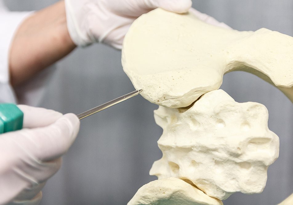 Il midollo osseo è responsabile della produzione delle cellule del sangue (globuli rossi, globuli bianchi e piastrine). Per i pazienti affetti da gravi malattie del sangue il trapianto di midollo osseo può rappresentare l’unica speranza di guarigione.