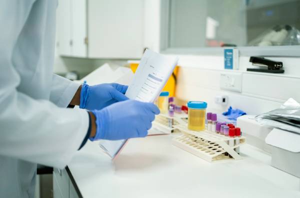 Tecnico di laboratorio prepara esami per infezione da escherichia coli