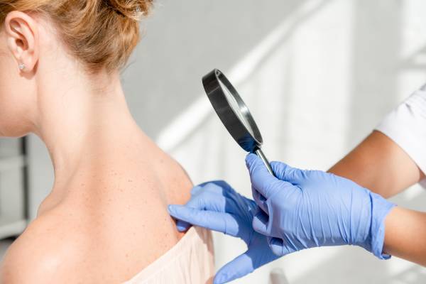 Dermatologo esamina pelle paziente per diagnosi tumore della pelle