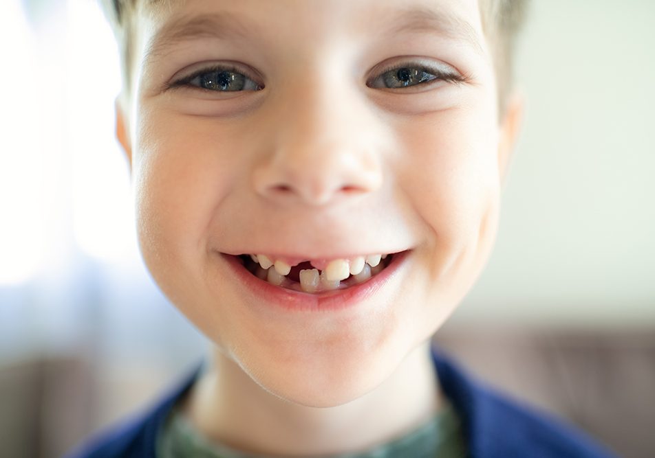 Sorriso di un bambino gioioso con denti da latte
