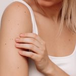 Donna si controlla la pelle per verificare eventuali cambiamenti e combattere il melanoma