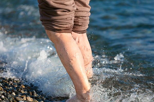 Donna matura che mantiene uno stile di vita e un peso sano, mentre cammina in riva al mare: alcuni dei metodi da seguire per far rientrare, o non peggiorare, le vene varicose