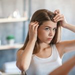 Giovane donna con dermatite seborroica si controlla il cuoio capelluto