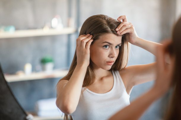 Giovane donna con dermatite seborroica si controlla il cuoio capelluto