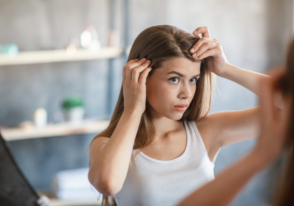 giovane-donna-con-dermatite-seborroica-cuoio-capelluto Giovane donna con dermatite seborroica si controlla il cuoio capelluto