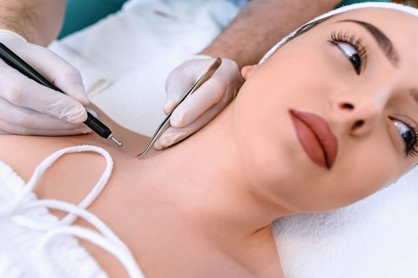 Giovane paziente dal dermatologo che, a causa di un sospetto melanoma, si sottopone a un intervento di asportazione di un neo nella zona delle spalle