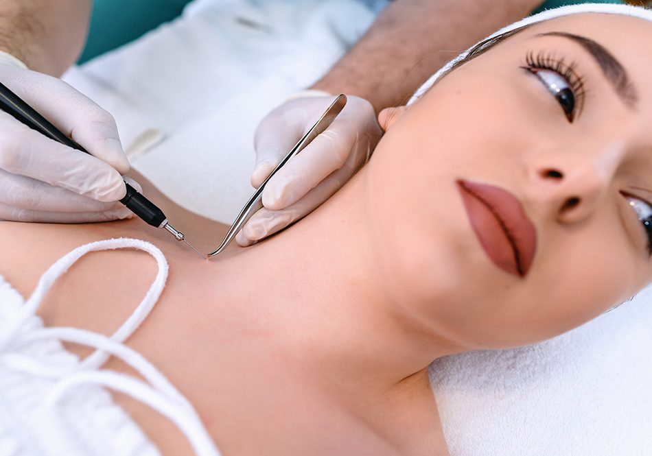 paziente-con-sospetto-melanoma-asportando-neo-dal-dermatologo Giovane paziente dal dermatologo che, a causa di un sospetto melanoma, si sottopone a un intervento di asportazione di un neo nella zona delle spalle