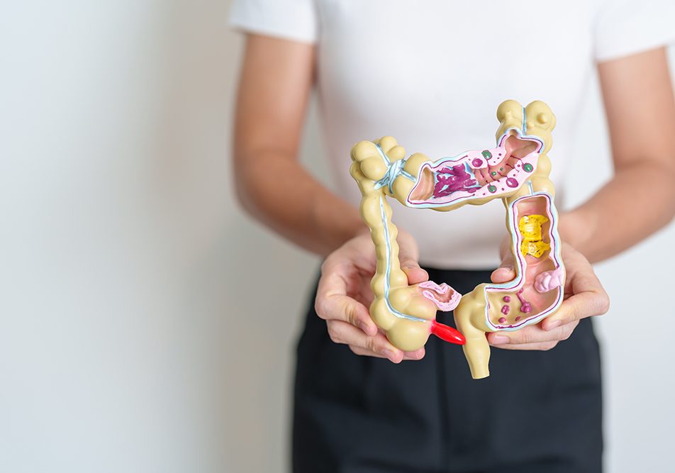 studentessa-mostrando-modello-intestino-rappresentazione-concetto-tumore Studentessa che mostra un modello anatomico dell’intestino a grandezza naturale per rappresentare il concetto di tumore e di prevenzione della salute intestinale