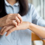 Donna con dermatite da contatto sulle mani si gratta le mani