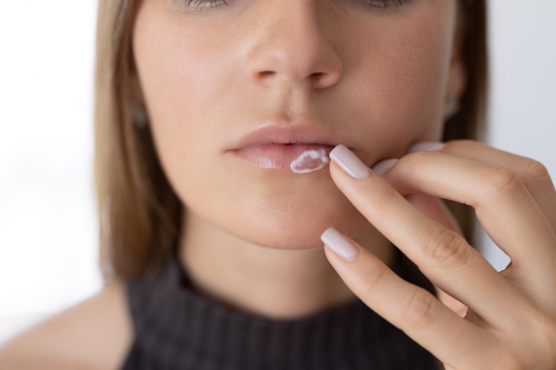 donna applica sul labbro gel contro herpes labiale