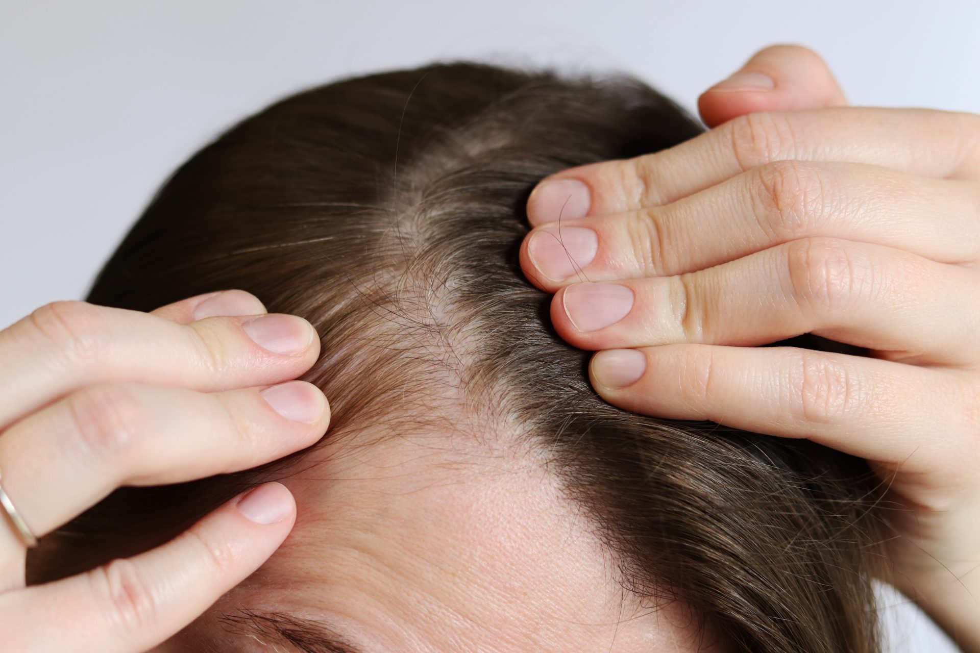 donna controlla diradamento capelli