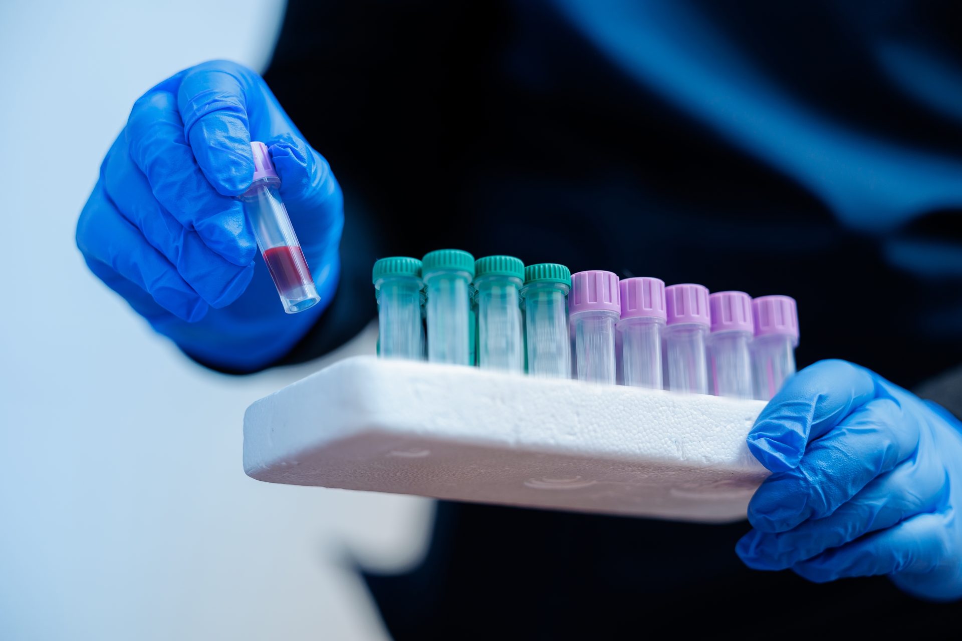 provette per analisi del sangue