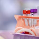 provette per analisi del sangue