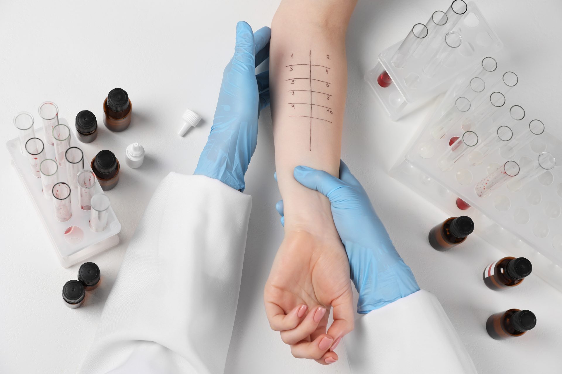 prick test