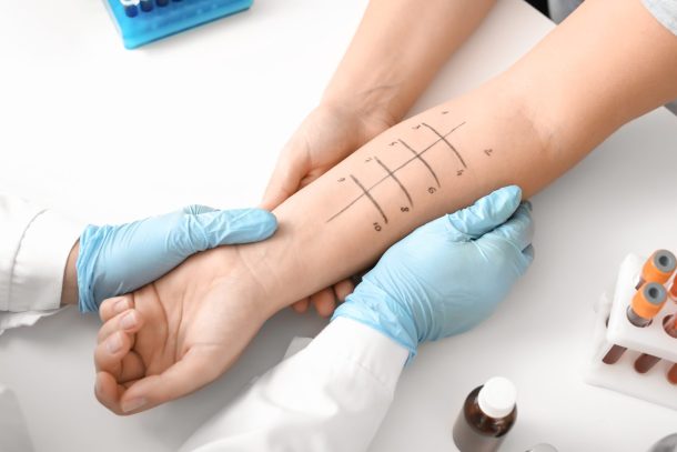 prick test