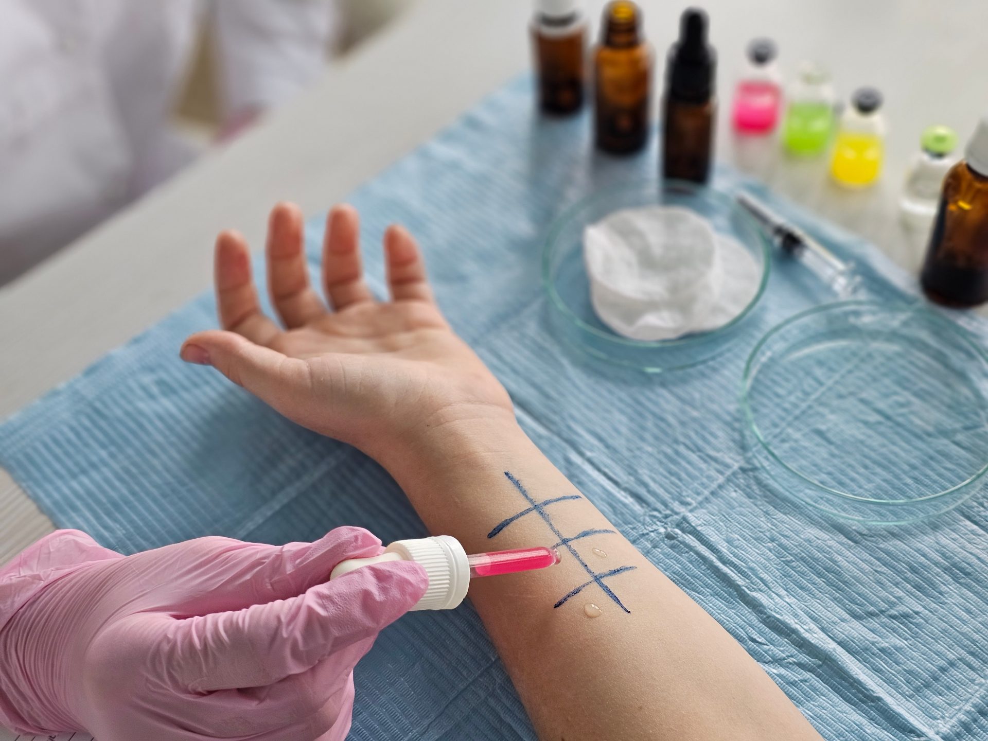 prick test