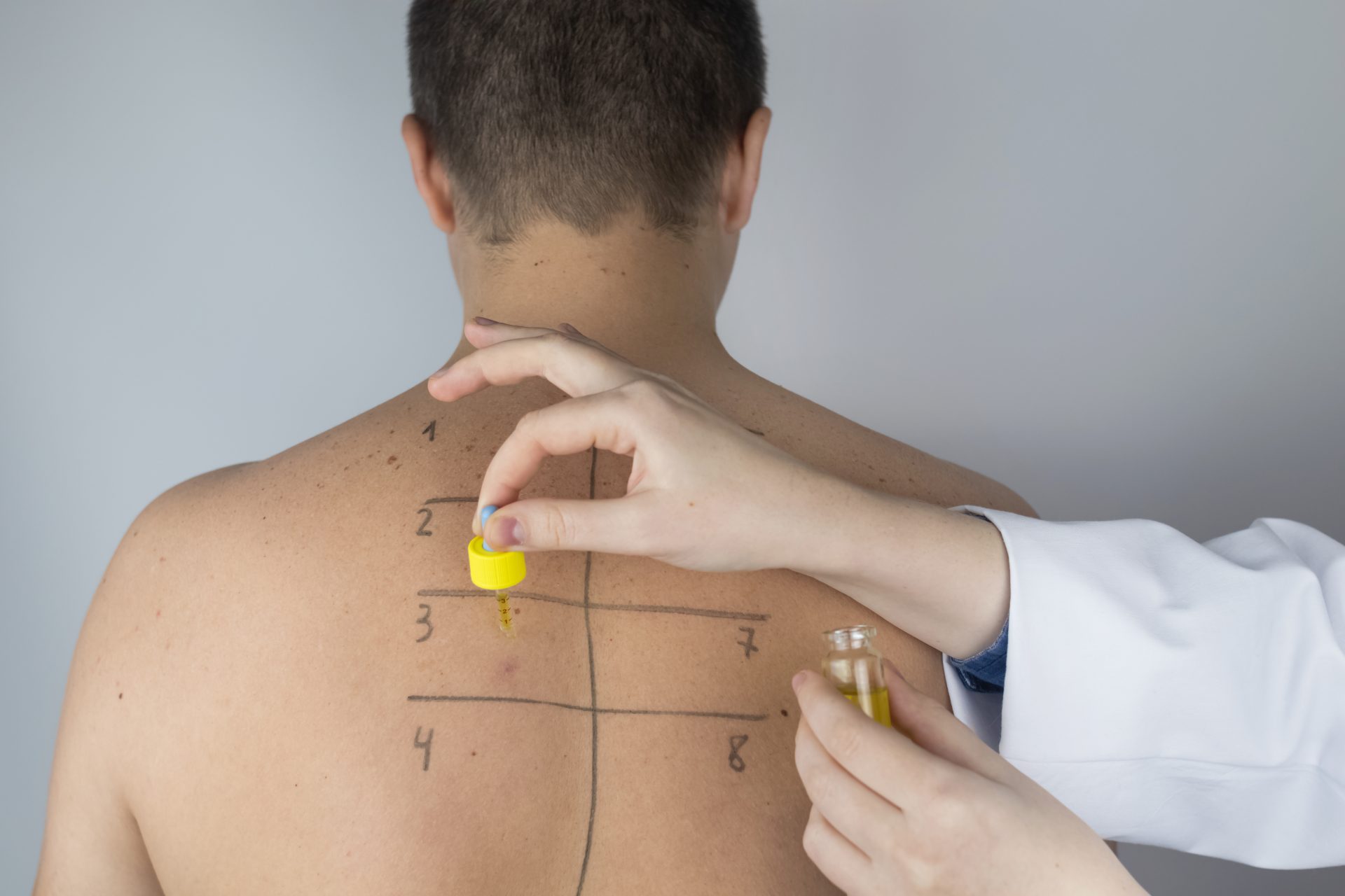 uomo si sottopone a patch test