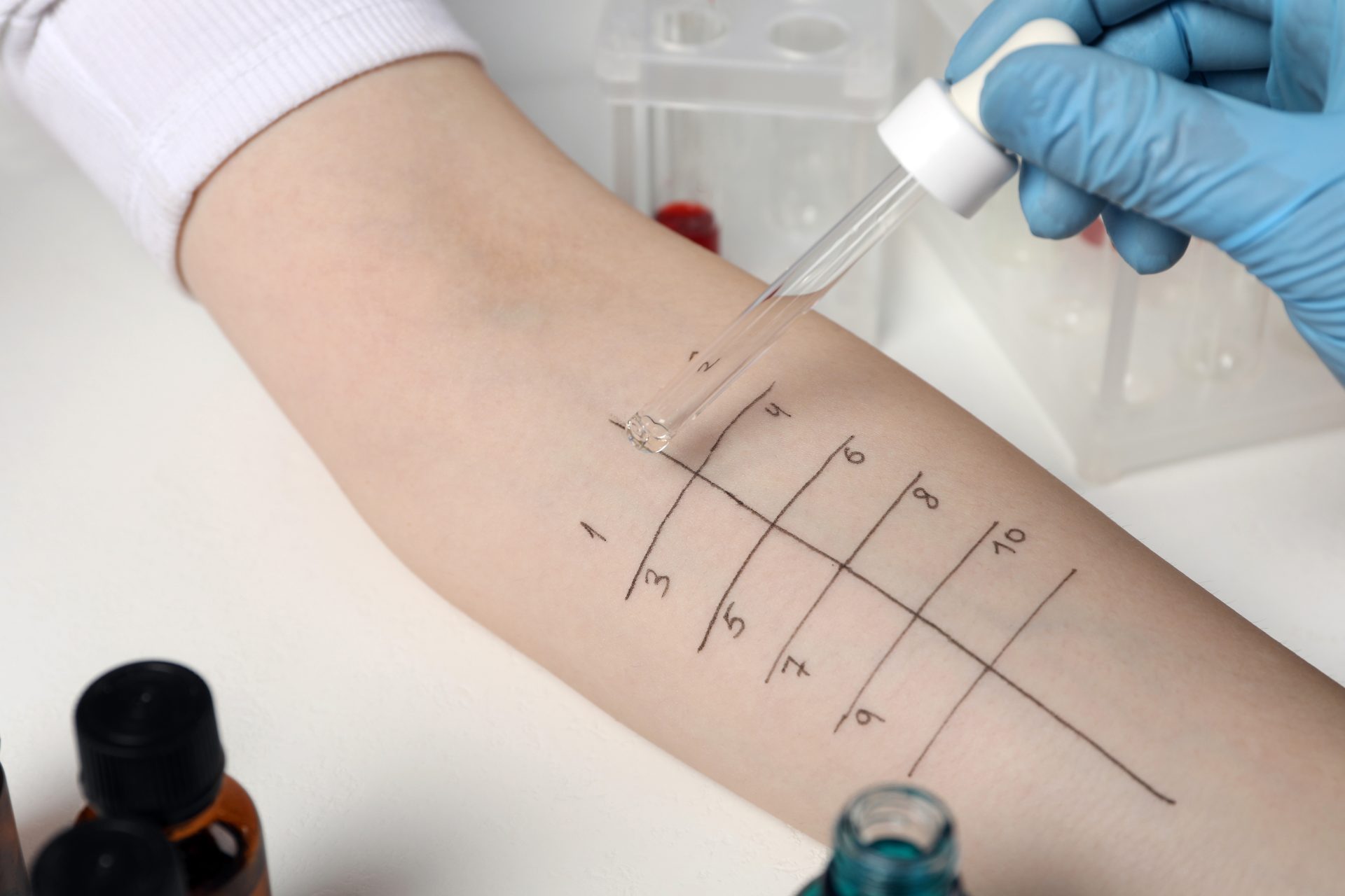 prick test
